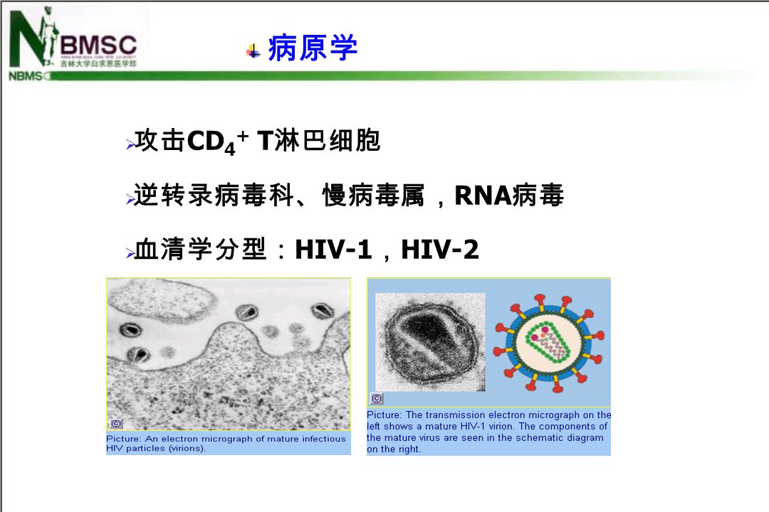  攻击 CD 4 + T 淋巴细胞  逆转录病毒科、慢病毒属， RNA 病毒  血清学分型： HIV-1 ， HIV-2 病原学