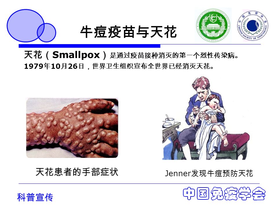 科普宣传 牛痘疫苗与天花 天花患者的手部症状 天花（ Smallpox ） 是通过疫苗接种消灭的第一个烈性传染病。 1979 年 10 月 26 日，世界卫生组织宣布全世界已经消灭天花。 Jenner 发现牛痘预防天花