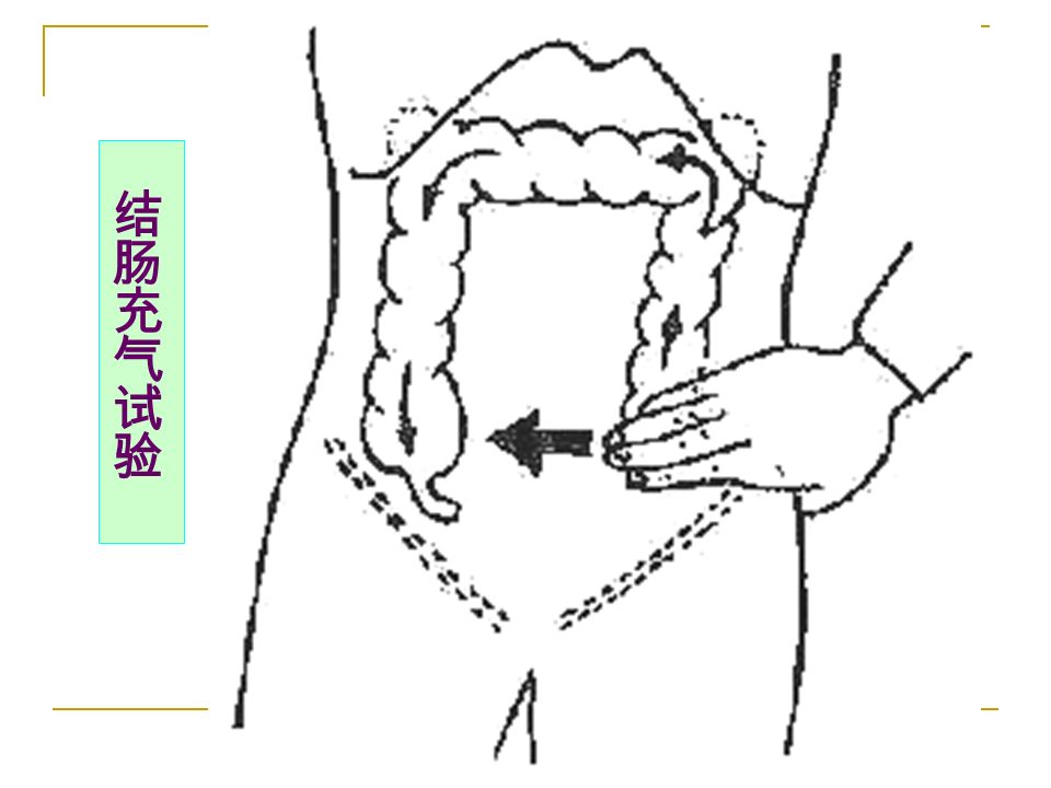 特殊检查 o ( 1 )结肠充气试验 o ( 2 )腰大肌试验 o ( 3 )闭孔内肌