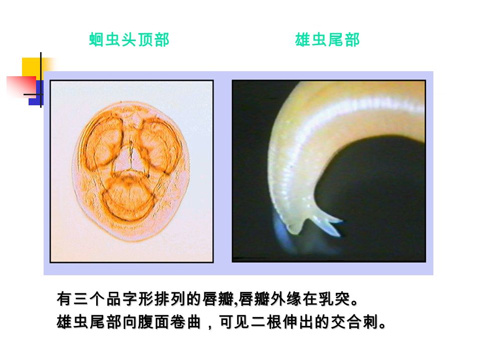 成虫寄生于人的小 肠,引起蛔虫病 ( ascariasis )