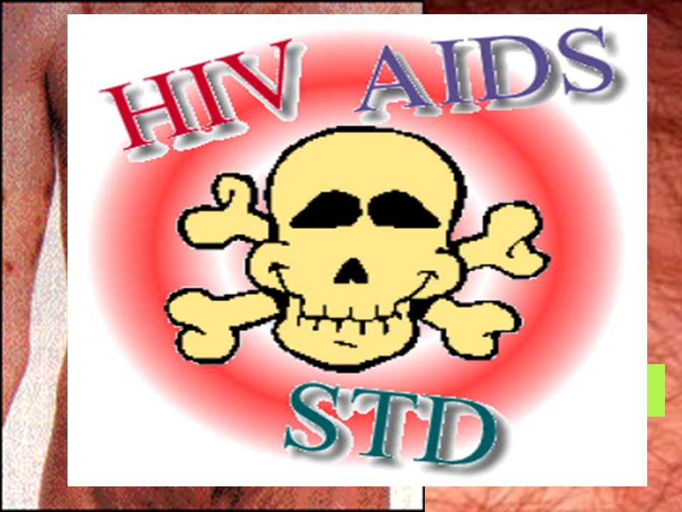 艾滋病病毒 (HIV) ) 艾滋病病毒模式图 艾滋病病毒的生活周期 动态演示 HIV 病毒 的感染过程 显示在 T 细胞表面有许多艾滋病病毒存在 艾滋病病毒 电镜照片 艾滋病皮肤病变 艾滋病卡波氏肉瘤