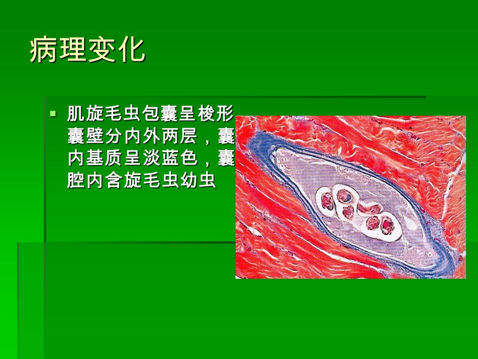 病理变化  肌旋毛虫包囊呈梭形， 囊壁分内外两层，囊 内基质呈淡蓝色，囊 腔内含旋毛虫幼虫