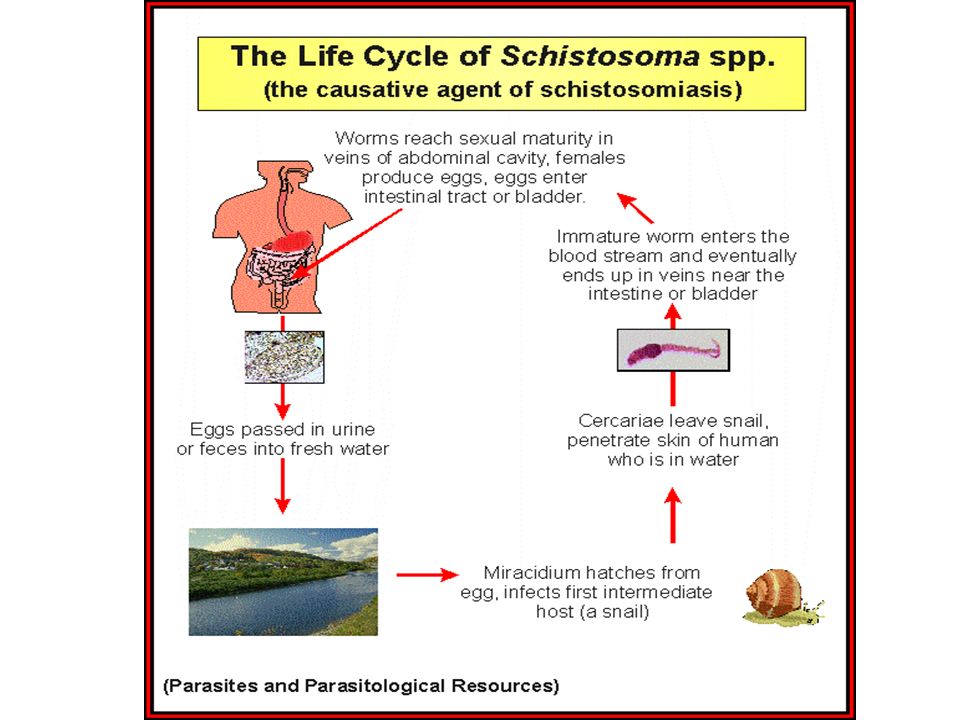 1 日本血吸虫病 schistosomiasis japonica. 2 83