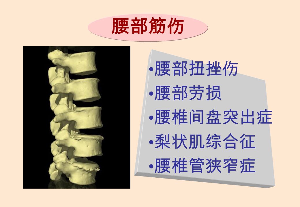 腰部筋伤 腰部扭挫伤 腰部劳损 腰椎间盘突出症 梨状肌综合征 腰椎管狭窄症