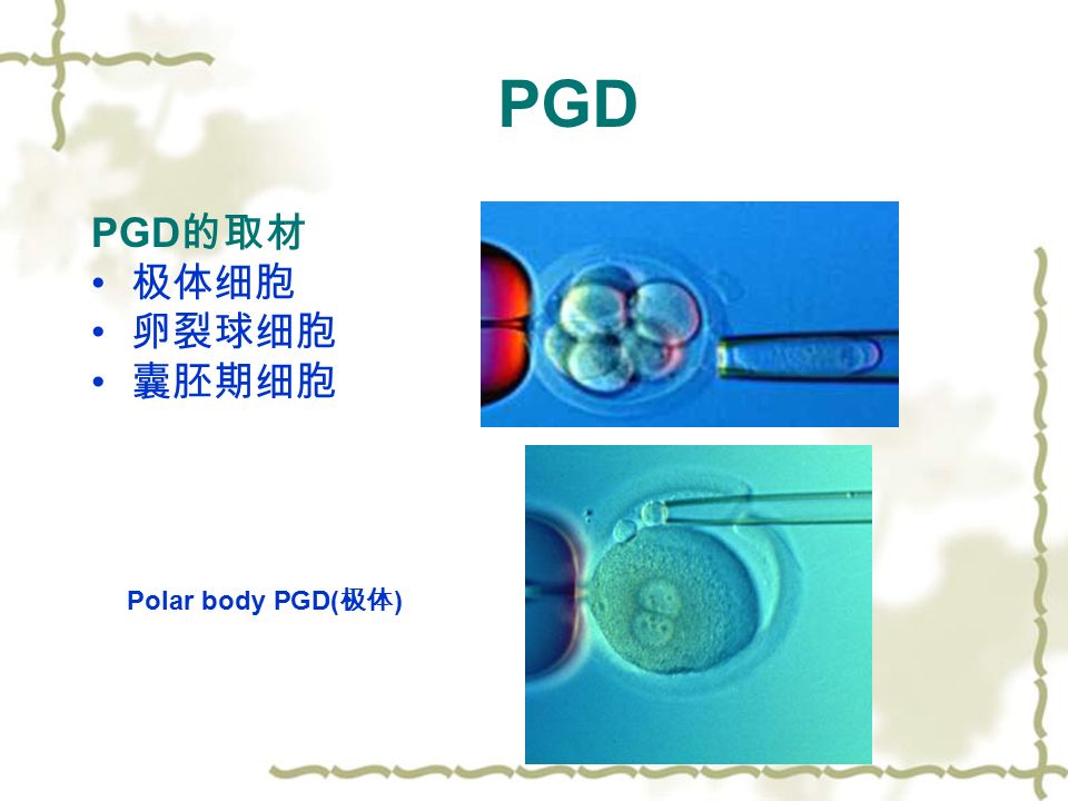 PGD 的取材 极体细胞 卵裂球细胞 囊胚期细胞 PGD Polar body PGD( 极体 )