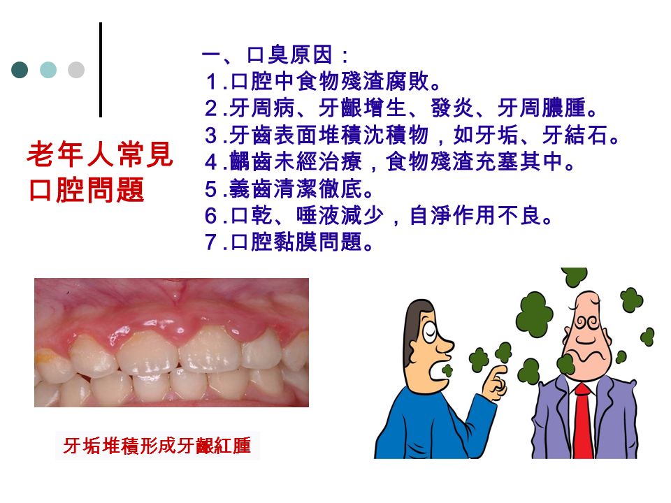 一、口臭原因： １. 口腔中食物殘渣腐敗。 ２. 牙周病、牙齦增生、發炎、牙周膿腫。 ３. 牙齒表面堆積沈積物，如牙垢、牙結石。 ４.