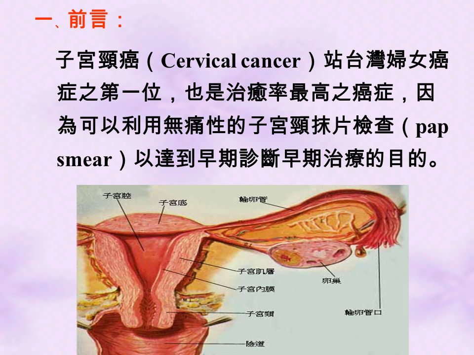 一 、 前言： 子宮頸癌（ Cervical cancer ）站台灣婦女癌 症之第一位，也是治癒率最高之癌症，因 為可以利用無痛性的子宮頸抹片檢查（ pap smear ）以達到早期診斷早期治療的目的。