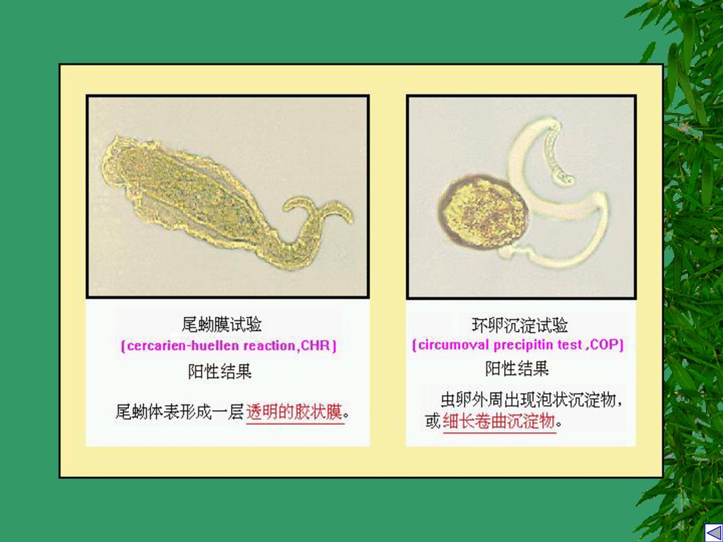 纤毛毛蚴 体部尾部尾蚴 钉螺中间宿主 尾蚴血吸虫生活史 血吸虫病兔