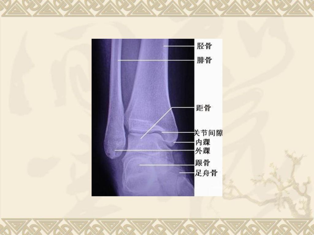 踝关节的解剖 (anatomy of ankle joint )