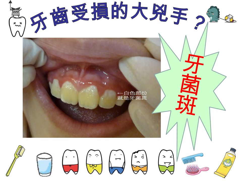 在牙齒表面會不停地形成一 層細菌薄膜，稱為牙菌斑。