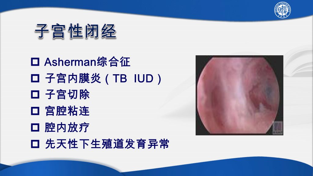  Asherman 综合征  子宫内膜炎（ TB IUD ）  子宫切除  宫腔粘连  腔内放疗  先天性下生殖道发育异常