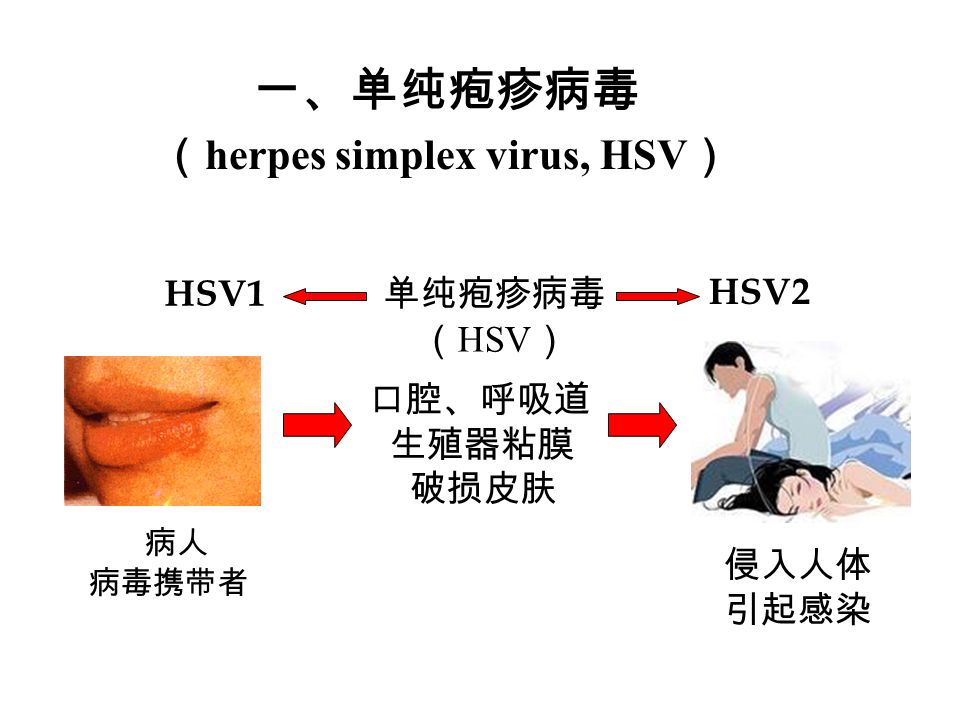 两包 可垂直 可潜伏 两链 疱疹病毒的共同特性 还有哪些病毒可 垂直感染？？？