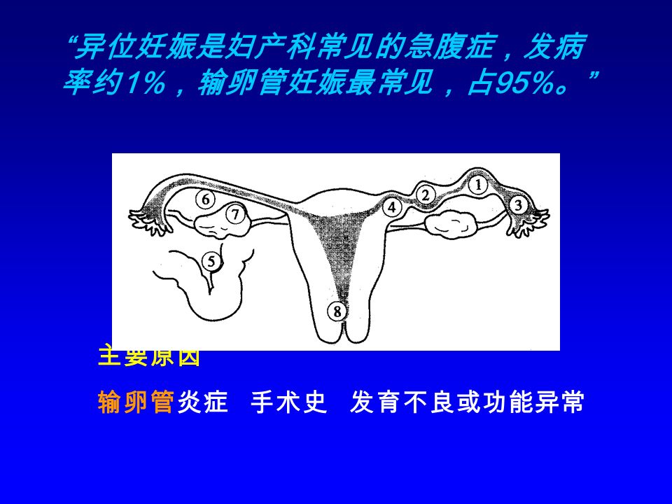 异位妊娠是妇产科常见的急腹症，发病 率约 1% ，输卵管妊娠最常见，占 95% 。 主要原因 输卵管炎症 手术史 发育不良或功能异常
