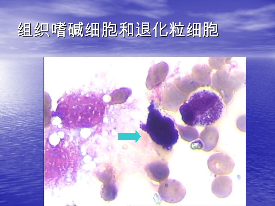 组织嗜碱细胞和退化粒细胞