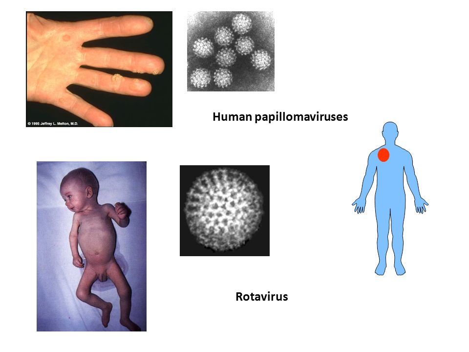 Human papillomaviruses Rotavirus