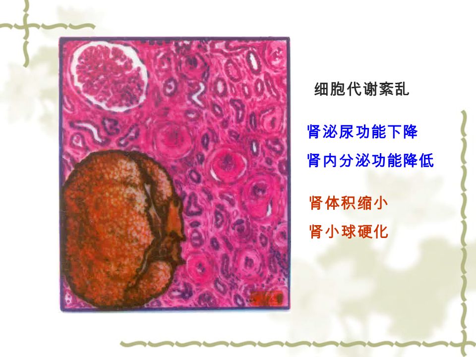 细胞代谢紊乱 肾泌尿功能下降 肾内分泌功能降低 肾体积缩小 肾小球硬化