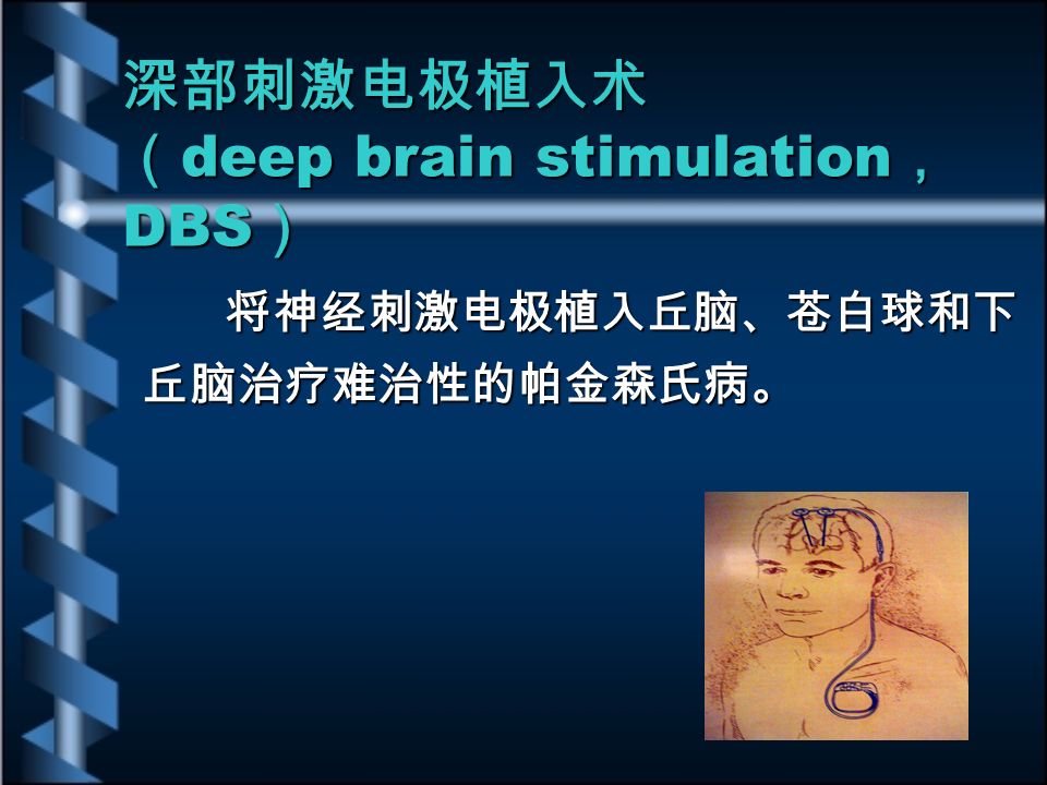 深部刺激电极植入术 （ deep brain stimulation ， DBS ） 将神经刺激电极植入丘脑、苍白球和下 丘脑治疗难治性的帕金森氏病。 将神经刺激电极植入丘脑、苍白球和下 丘脑治疗难治性的帕金森氏病。