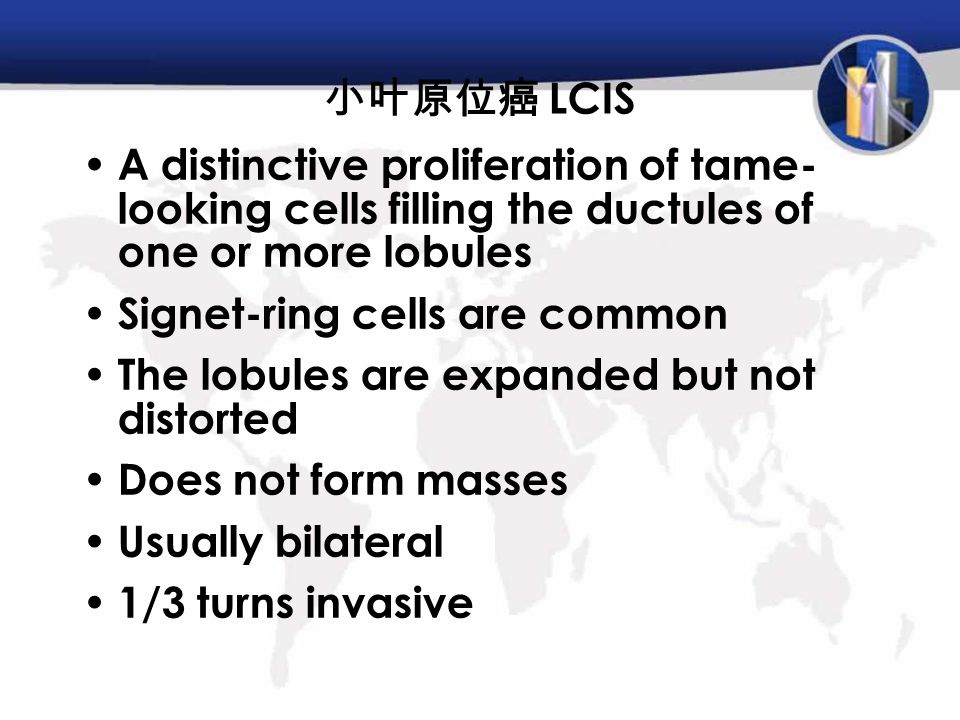 A distinctive proliferation of tame- looking cells filling the ductules of one or more lobules Signet-ring cells are common The lobules are expanded but not distorted Does not form masses Usually bilateral 1/3 turns invasive 小叶原位癌 LCIS