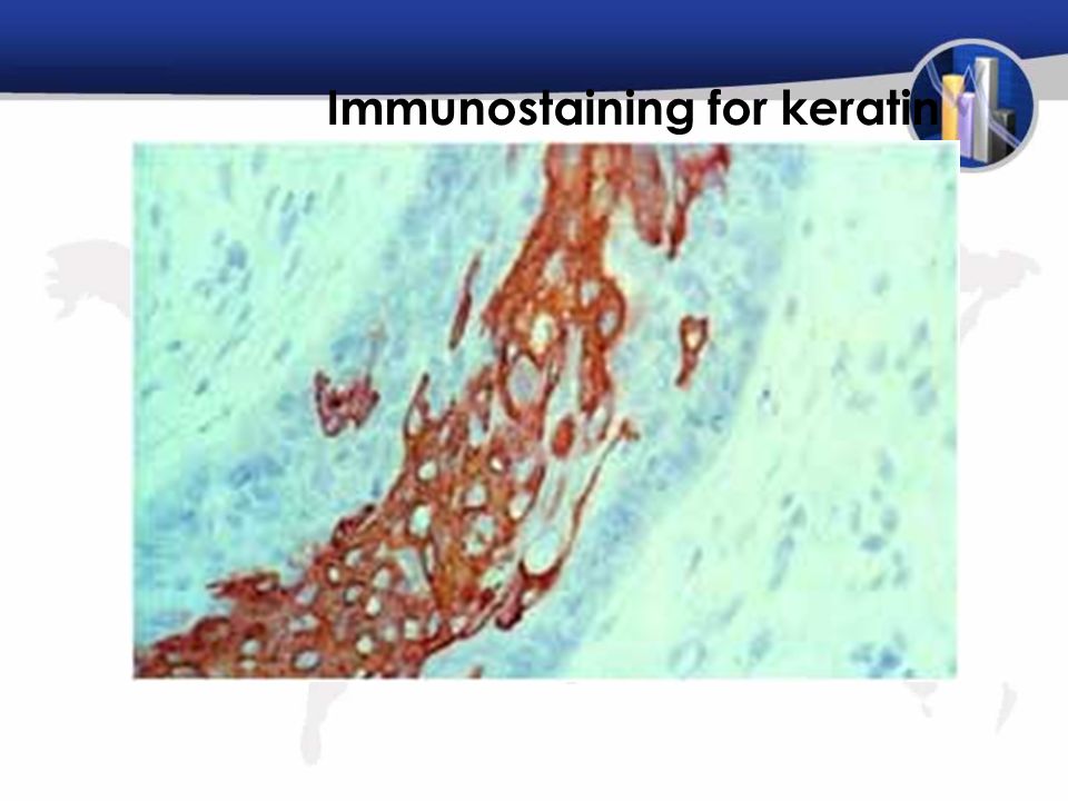 Immunostaining for keratin