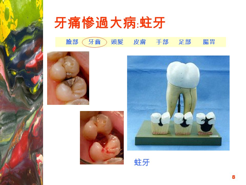 8 牙痛慘過大病﹕蛀牙 蛀牙 臉部 牙齒 頭髮 皮膚 手部 足部 腸胃
