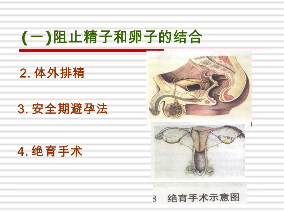 3. 安全期避孕法 4. 绝育手术 2. 体外排精 ( 一 ) 阻止精子和卵子的结合
