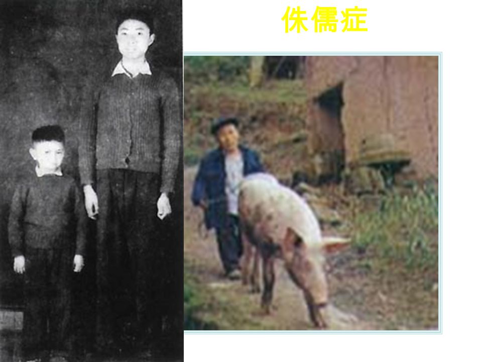 资料下载 阳鸣村，位 于四川资中县， 几十年下来，全 村男女几乎一个 身段 ——80 厘米 左右，有的竟然 只有 40 多厘米高。 此一个村子的矮 子之集中堪称 世 界之最 。