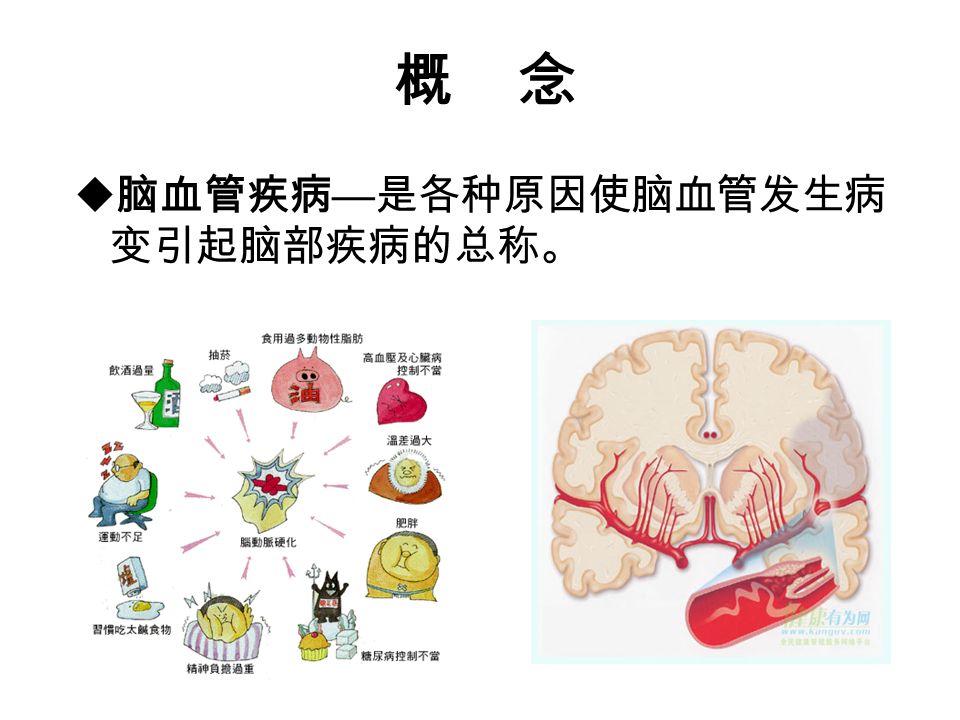 概 念  脑血管疾病 — 是各种原因使脑血管发生病 变引起脑部疾病的总称。