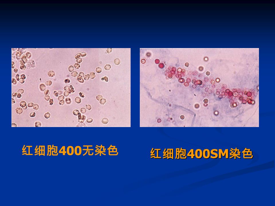 红细胞 400SM 染色 红细胞 400 无染色