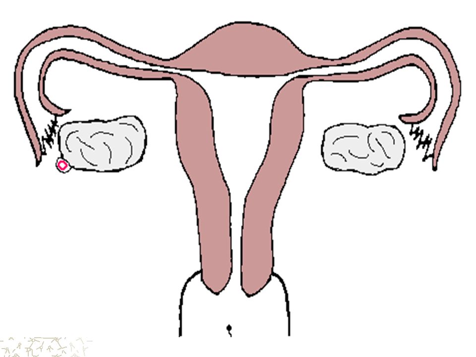 输卵管妊娠的变化  输卵管妊娠的变化与结局：输卵 管妊娠流产、输卵管妊娠破裂和 继发性腹腔妊娠。 病理