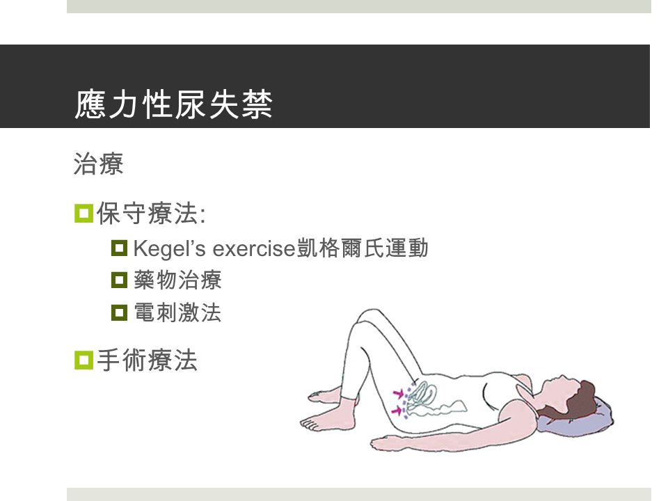 應力性尿失禁 治療  保守療法 :  Kegel’s exercise 凱格爾氏運動  藥物治療  電刺激法  手術療法