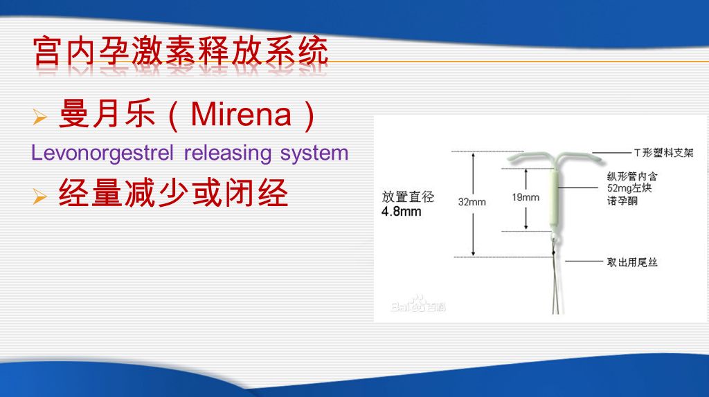  曼月乐（ Mirena ） Levonorgestrel releasing system  经量减少或闭经