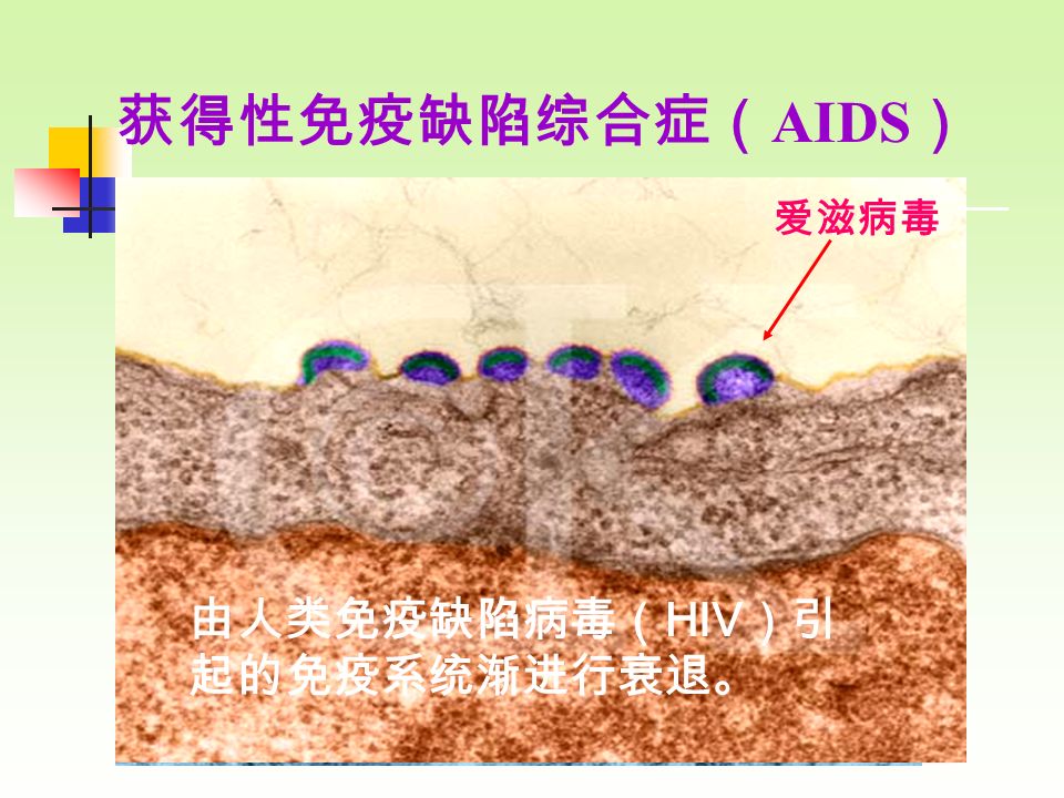 由人类免疫缺陷病毒（ HIV ）引起的 免疫系统渐进行衰退。 爱滋病毒感染 T 细胞 爱滋病毒 获得性免疫缺陷综合症（ AIDS ） 由人类免疫缺陷病毒（ HIV ）引 起的免疫系统渐进行衰退。