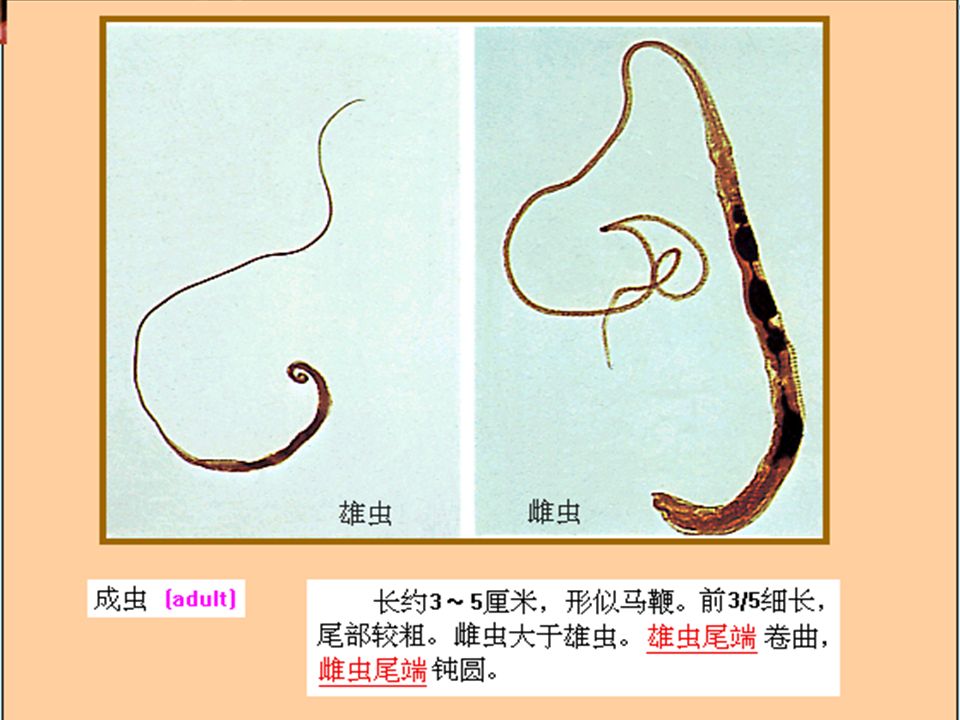 一、形态 1 、成虫 形似马鞭，虫体前 3/5 细长，后 2/5 粗大。 雌虫大，尾端钝圆而直。 雄虫小，尾端向腹面弯曲。