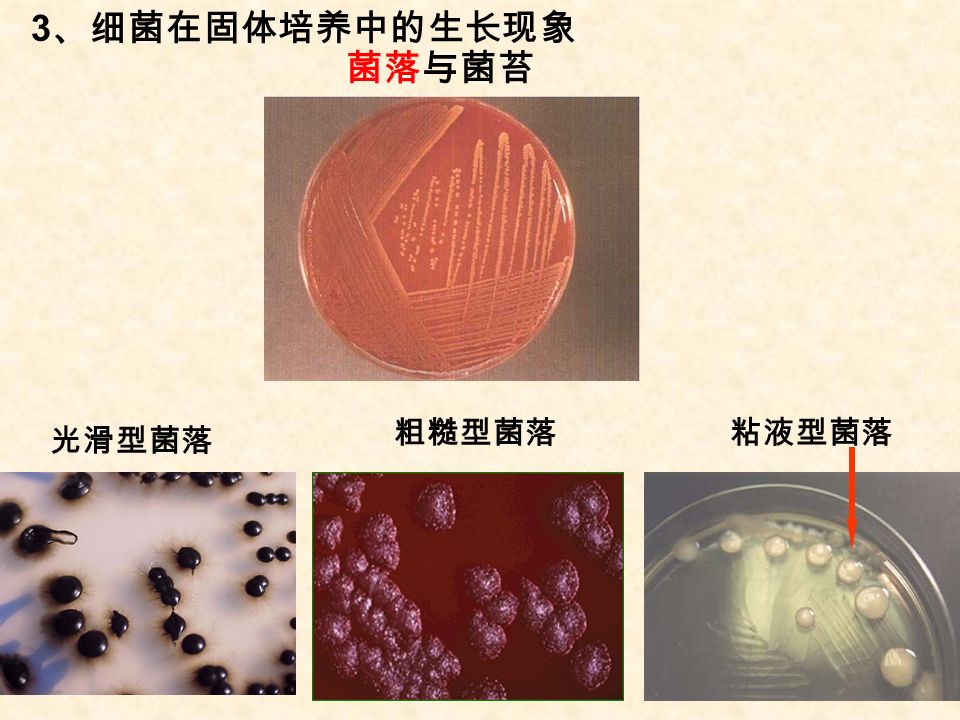 24 3 、细菌在固体培养中的生长现象 菌落与菌苔 光滑型菌落 粗糙型菌落 粘液型菌落