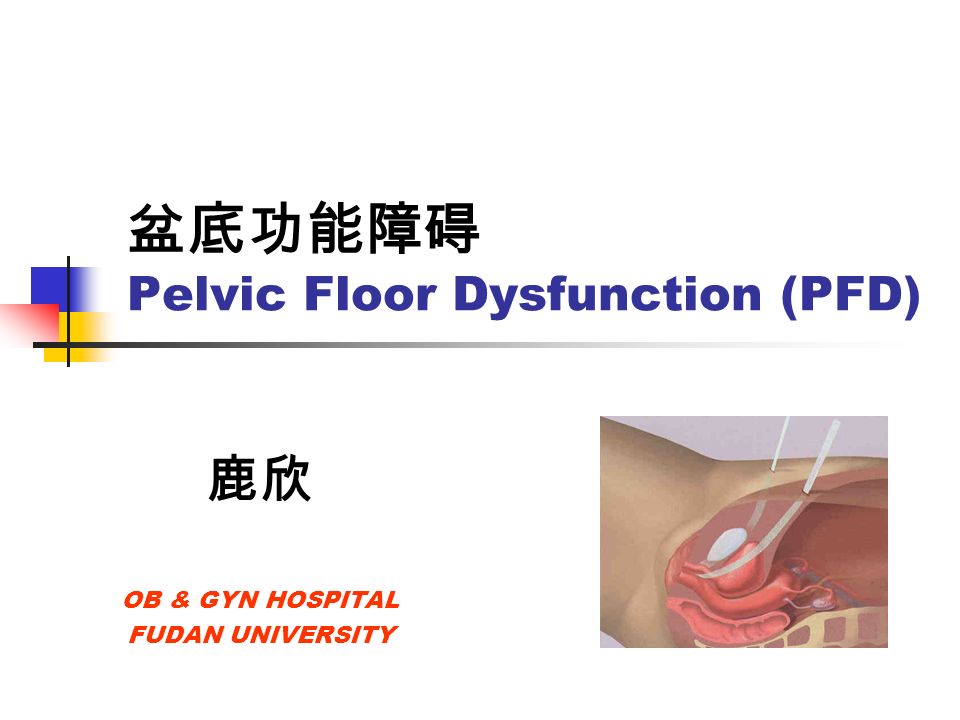 盆底功能障碍 Pelvic Floor Dysfunction (PFD) 鹿欣 OB & GYN HOSPITAL FUDAN UNIVERSITY