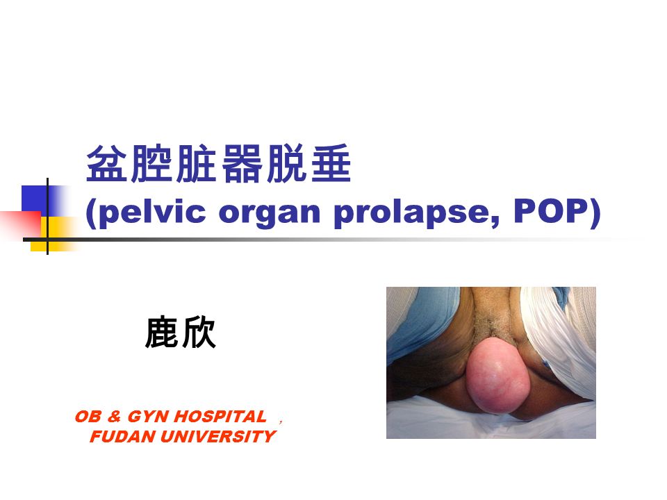 盆腔脏器脱垂 (pelvic organ prolapse, POP) 鹿欣 OB & GYN HOSPITAL ， FUDAN UNIVERSITY