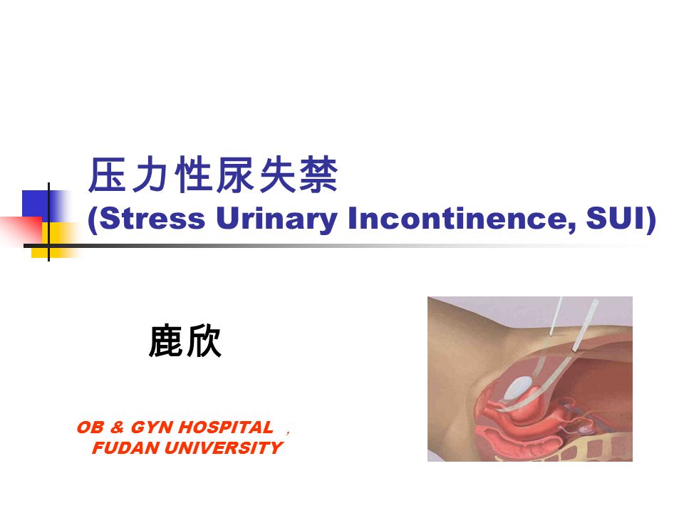 压力性尿失禁 (Stress Urinary Incontinence, SUI) 鹿欣 OB & GYN HOSPITAL ， FUDAN UNIVERSITY