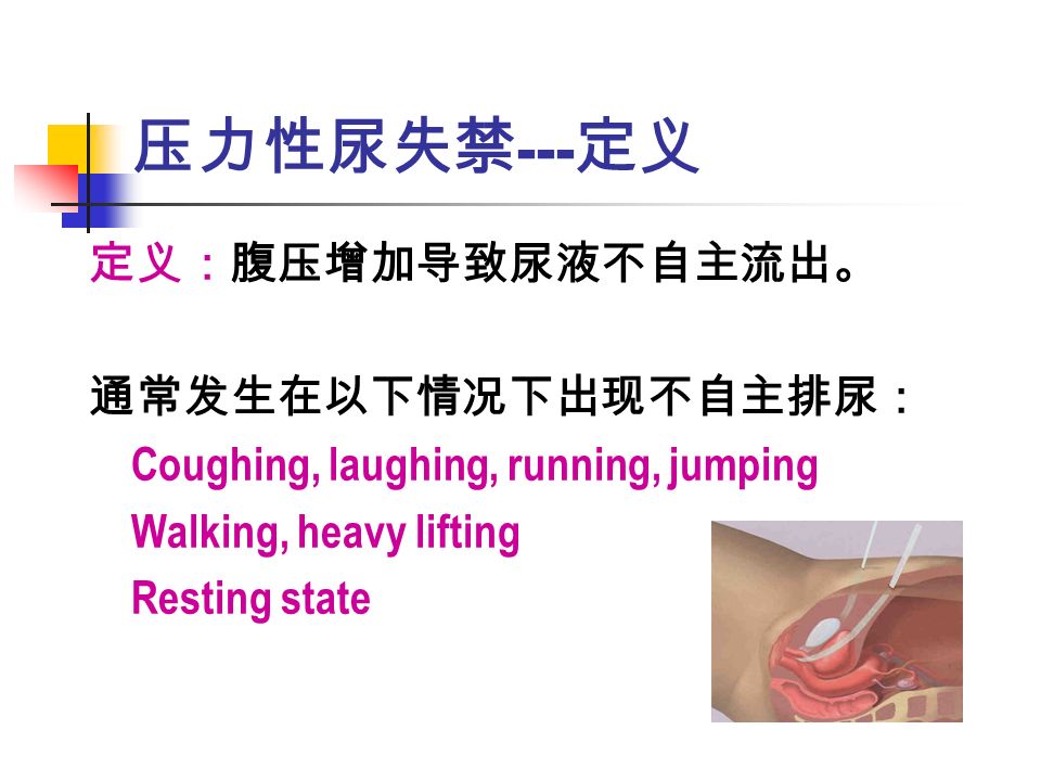 压力性尿失禁 --- 定义 定义：腹压增加导致尿液不自主流出。 通常发生在以下情况下出现不自主排尿： Coughing, laughing, running, jumping Walking, heavy lifting Resting state