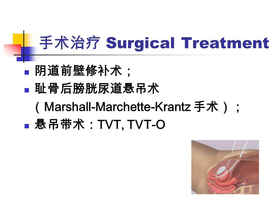 手术治疗 Surgical Treatment 阴道前壁修补术； 耻骨后膀胱尿道悬吊术 （ Marshall-Marchette-Krantz 手术）； 悬吊带术： TVT, TVT-O