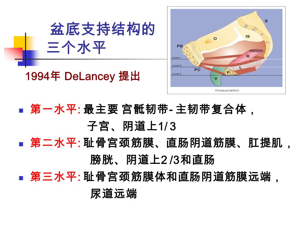盆底支持结构的 三个水平 1994 年 DeLancey 提出 第一水平 : 最主要 宫骶韧带 - 主韧带复合体， 子宫、阴道上 1/ 3 第二水平 : 耻骨宫颈筋膜、直肠阴道筋膜、肛提肌， 膀胱、阴道上 2 /3 和直肠 第三水平 : 耻骨宫颈筋膜体和直肠阴道筋膜远端， 尿道远端