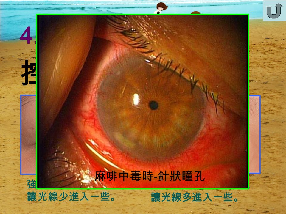 3. 結膜： 覆蓋於鞏膜（眼白）上 特色：一層半透明的黏膜 。 功能：分泌黏液配合淚水， 濕潤眼睛外部。