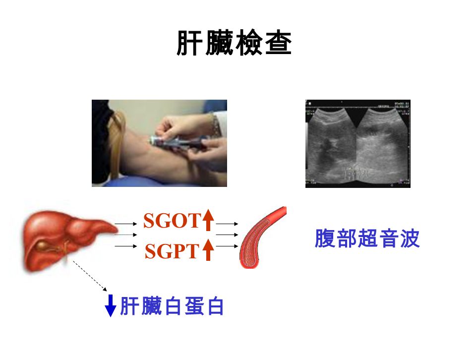 肝臟檢查 SGOT SGPT 肝臟白蛋白 腹部超音波