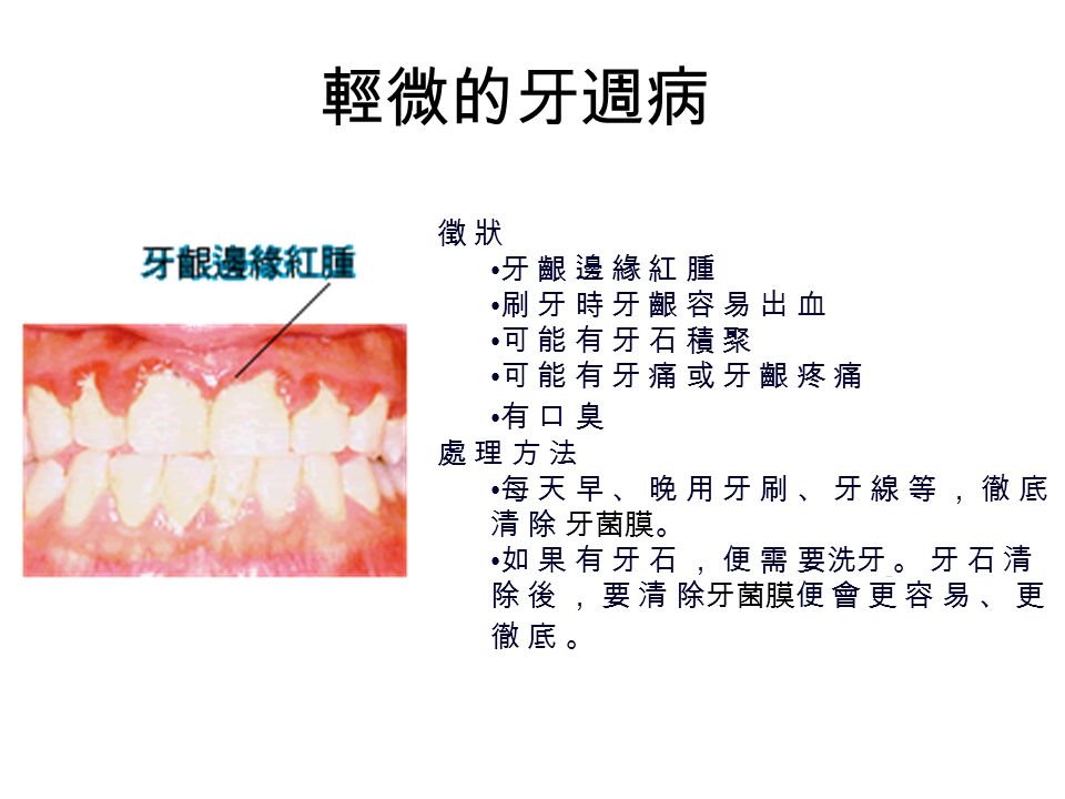 健康牙齦
