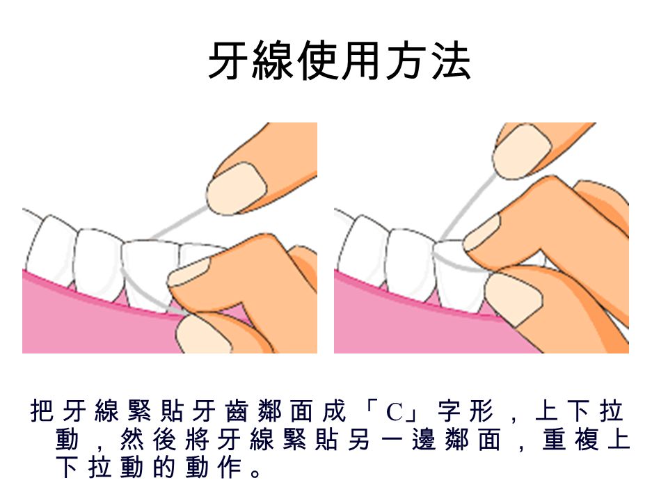 牙線使用方法 將 牙 線 前 後 拉 動 ， 慢 慢 地 讓 它 滑 進 牙 縫 內 。將 牙 線 前 後 拉 動 ， 慢 慢 地 讓 它 滑 進 牙 縫 內 。