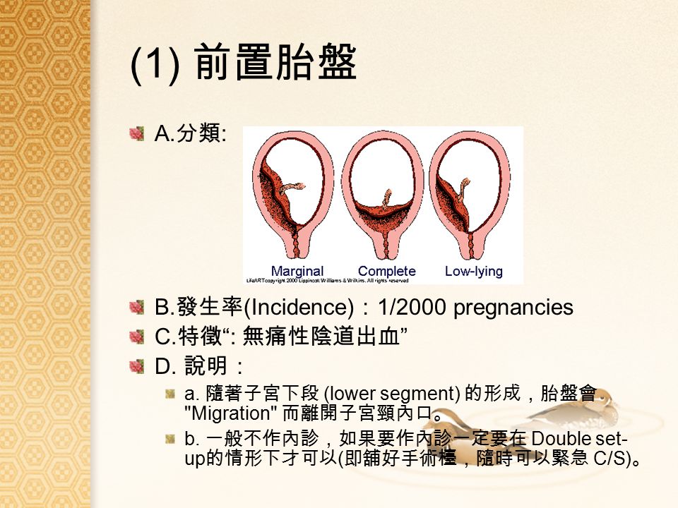 (1) 前置胎盤 A. 分類 : B. 發生率 (Incidence) ： 1/2000 pregnancies C.