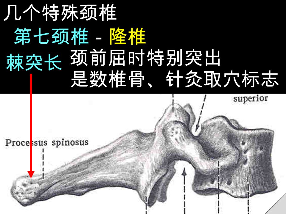棘突长 第七颈椎－隆椎 颈前屈时特别突出 是数椎骨、针灸取穴标志 几个特殊颈椎