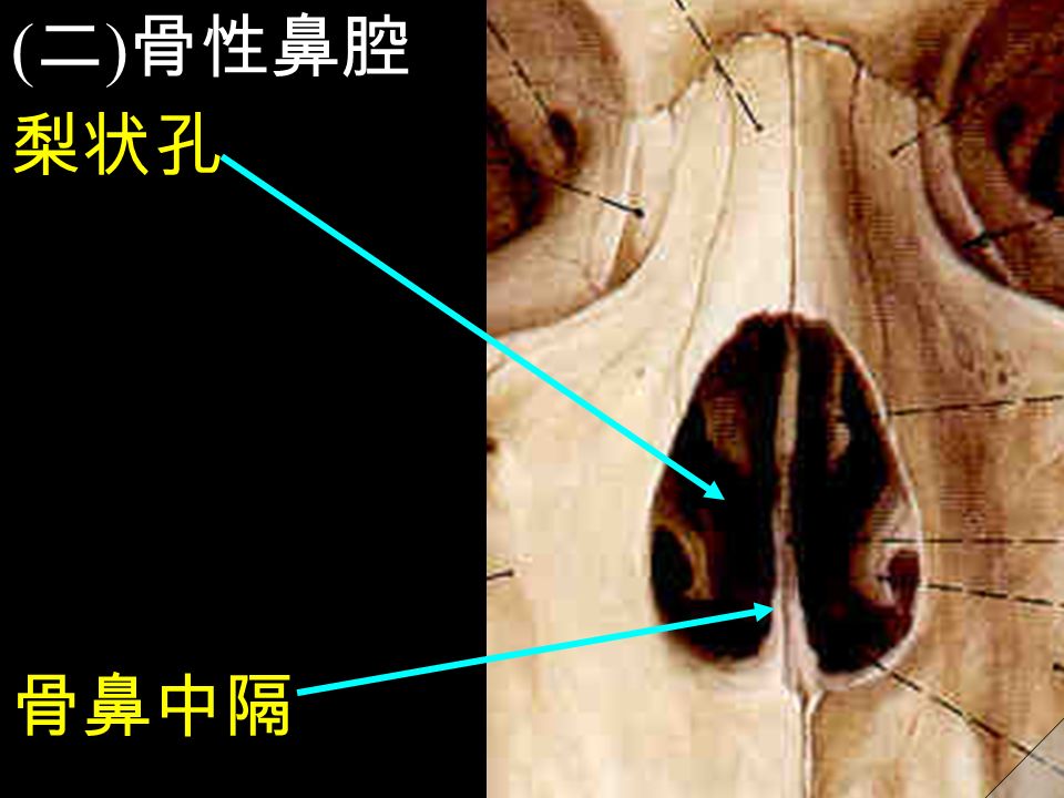 ( 二 ) 骨性鼻腔 梨状孔 骨鼻中隔