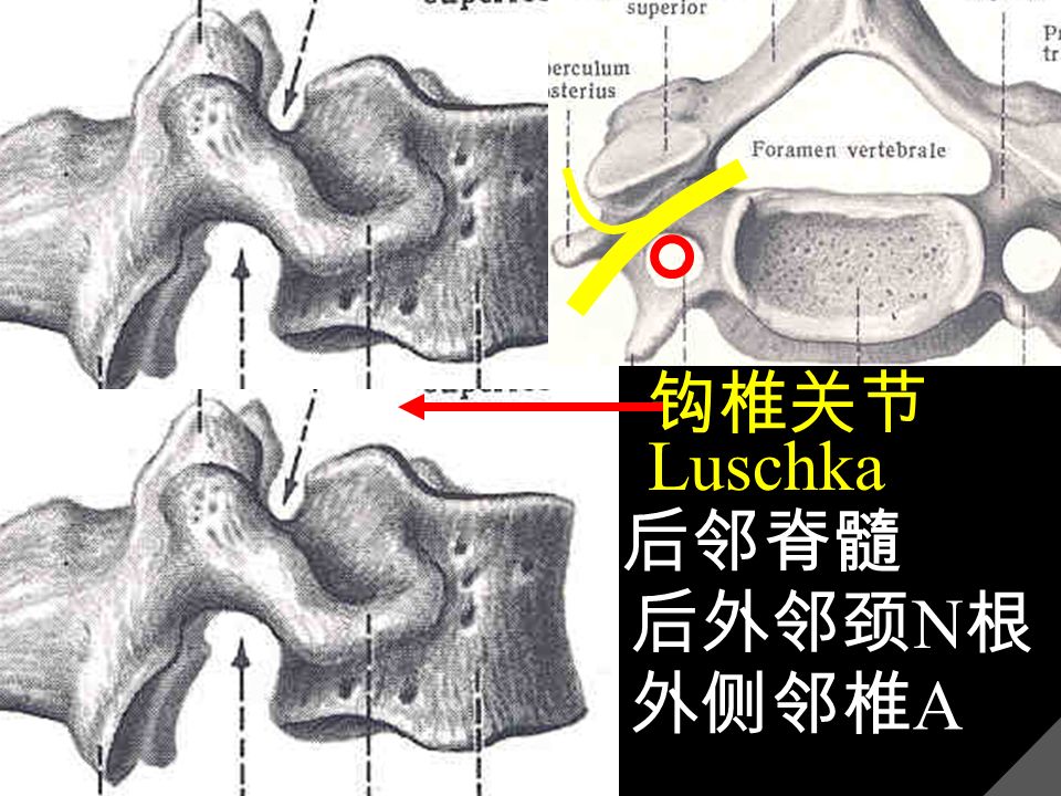钩椎关节 Luschka 后邻脊髓 后外邻颈 N 根 外侧邻椎 A