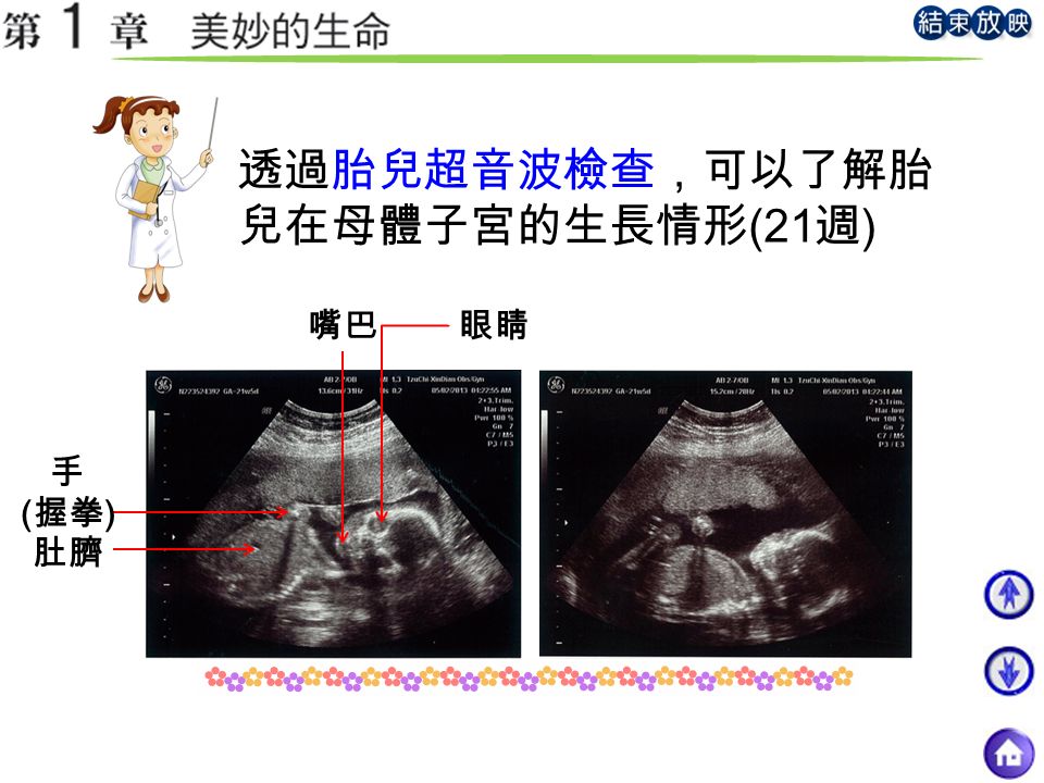 透過胎兒超音波檢查，可以了解胎 兒在母體子宮的生長情形 (21 週 ) 嘴巴眼睛 手 ( 握拳 ) 肚臍