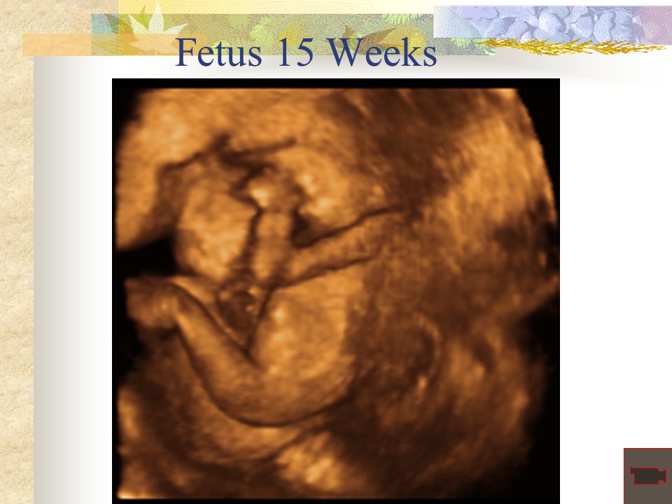 Fetus 15 Weeks